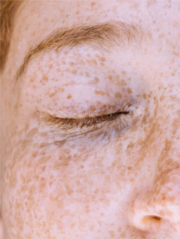 Vitamine C-serum